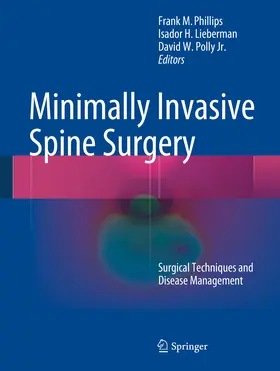Phillips / Lieberman / Polly |  Minimally Invasive Spine Surgery | eBook | Sack Fachmedien