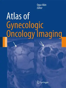 Akin |  Atlas of Gynecologic Oncology Imaging | Buch |  Sack Fachmedien