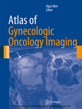 Akin | Atlas of Gynecologic Oncology Imaging | E-Book | sack.de