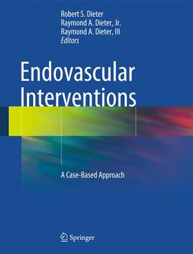 Dieter / Dieter, Jr. / Dieter, III |  Endovascular Interventions | Buch |  Sack Fachmedien