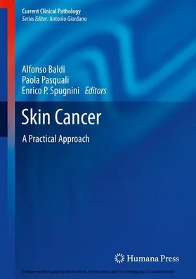 Baldi / Pasquali / Spugnini | Skin Cancer | E-Book | www.sack.de