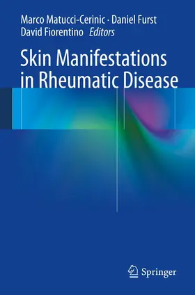 Matucci-Cerinic / Furst / Fiorentino |  Skin Manifestations in Rheumatic Disease | eBook | Sack Fachmedien