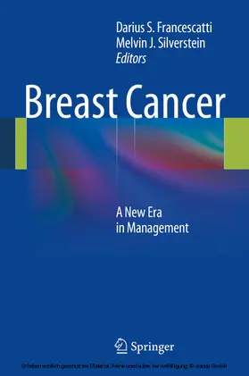 Francescatti / Silverstein |  Breast Cancer | eBook | Sack Fachmedien