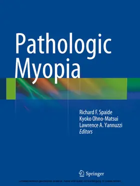 Spaide / Ohno-Matsui / Yannuzzi |  Pathologic Myopia | eBook | Sack Fachmedien