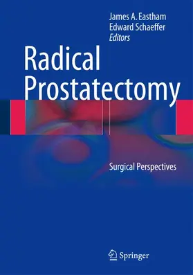 Eastham / Schaeffer |  Radical Prostatectomy | Buch |  Sack Fachmedien