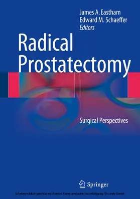 Eastham / Schaeffer |  Radical Prostatectomy | eBook | Sack Fachmedien