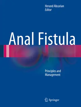 Abcarian |  Anal Fistula | eBook | Sack Fachmedien