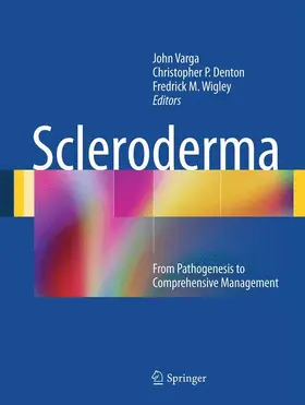 Varga / Denton / Wigley |  Scleroderma | Buch |  Sack Fachmedien