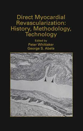 Whittaker / Abela | Direct Myocardial Revascularization: History, Methodology, Technology | E-Book | www.sack.de