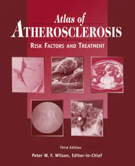 Wilson |  Atlas of Atherosclerosis | eBook | Sack Fachmedien