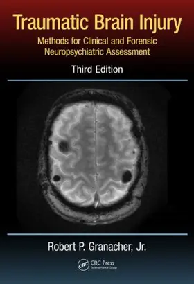 Granacher Jr. / Lund | Traumatic Brain Injury | Buch | 978-1-4665-9480-7 | sack.de