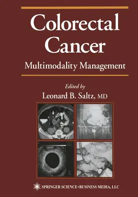 Saltz |  Colorectal Cancer | Buch |  Sack Fachmedien