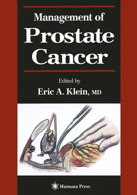 Klein | Management of Prostate Cancer | Buch | 978-1-4684-9826-4 | sack.de