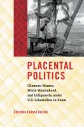 Delisle |  Placental Politics | Buch |  Sack Fachmedien