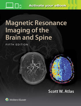 Atlas | Atlas, S: Magnetic Resonance Imaging of the Brain and Spine | Buch | 978-1-4698-7320-6 | sack.de