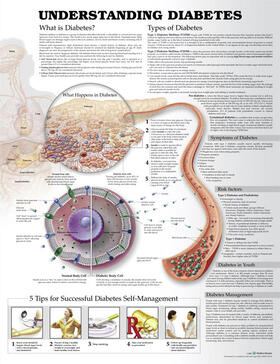 Unger |  Understanding Diabetes Anatomical Chart | Sonstiges |  Sack Fachmedien