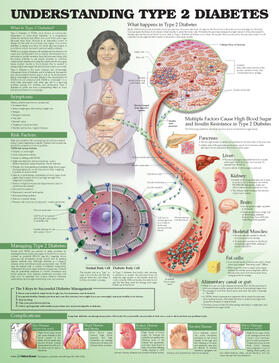 Unger |  Understanding Type 2 Diabetes Anatomical Chart | Sonstiges |  Sack Fachmedien