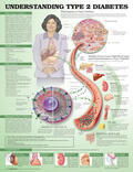 Unger / Anatomical Chart Company |  Understanding Type 2 Diabetes Anatomical Chart. Laminated | Sonstiges |  Sack Fachmedien
