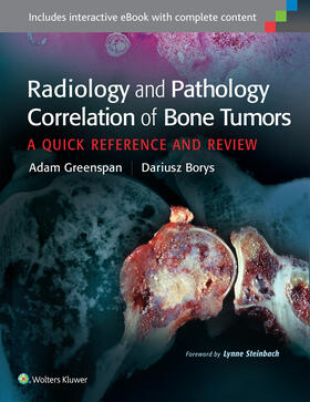 Greenspan / Borys |  Radiology and Pathology Correlation of Bone Tumors | Buch |  Sack Fachmedien