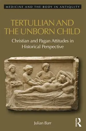 Barr |  Tertullian and the Unborn Child | Buch |  Sack Fachmedien
