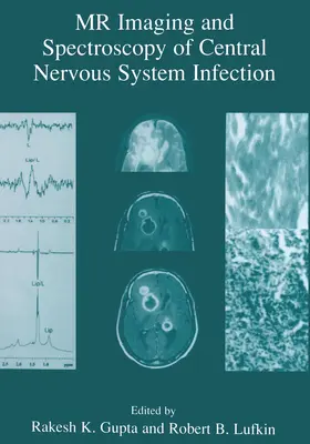 Lufkin / Gupta |  MR Imaging and Spectroscopy of Central Nervous System Infection | Buch |  Sack Fachmedien