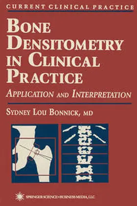 Bonnick |  Bone Densitometry in Clinical Practice | eBook | Sack Fachmedien