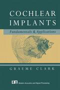 Clark |  Cochlear Implants | Buch |  Sack Fachmedien