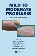 Koo / Levin / Leon |  Mild to Moderate Psoriasis | Buch |  Sack Fachmedien