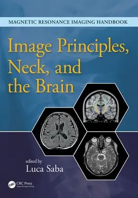 Saba | Image Principles, Neck, and the Brain | Buch | 978-1-4822-1613-4 | www.sack.de