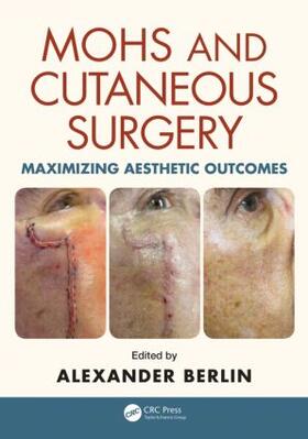 Berlin | Mohs and Cutaneous Surgery | Buch | 978-1-4822-2136-7 | sack.de