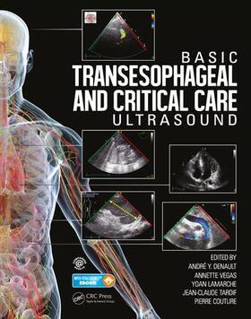 Denault / Vegas / Lamarche | Basic Transesophageal and Critical Care Ultrasound | Buch | 978-1-4822-3712-2 | sack.de