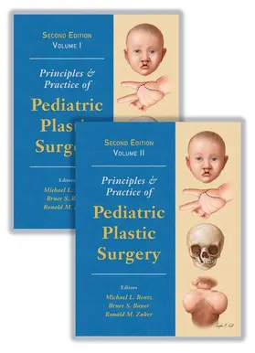Bentz / Bauer / Zuker | Principles and Practice of Pediatric Plastic Surgery | Medienkombination | 978-1-4822-4137-2 | www.sack.de
