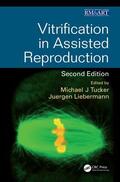 Tucker / Liebermann |  Vitrification in Assisted Reproduction | Buch |  Sack Fachmedien