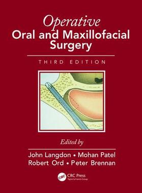 Langdon / Patel / Ord | Operative Oral and Maxillofacial Surgery | Buch | 978-1-4822-5204-0 | sack.de