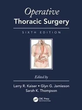 Kaiser / Thompson / Jamieson | Operative Thoracic Surgery | Buch | 978-1-4822-9957-1 | www.sack.de