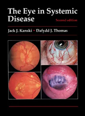 Kanski / Thomas |  The Eye in Systemic Disease | eBook | Sack Fachmedien