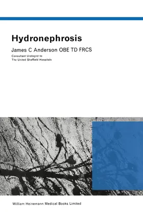 Anderson |  Hydronephrosis | eBook | Sack Fachmedien