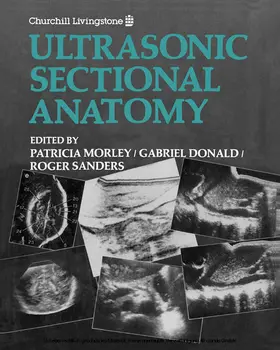 Morley / Donald / Sanders MD |  Ultrasonic Sectional Anatomy | eBook | Sack Fachmedien