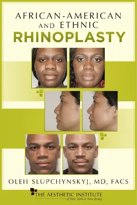 Oleh Slupchynskyj / Slupchynskyj / MD |  African-American and Ethnic Rhinoplasty | eBook | Sack Fachmedien
