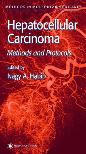 Habib |  Hepatocellular Carcinoma | Buch |  Sack Fachmedien