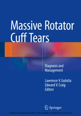 Gulotta / Craig | Massive Rotator Cuff Tears | E-Book | www.sack.de