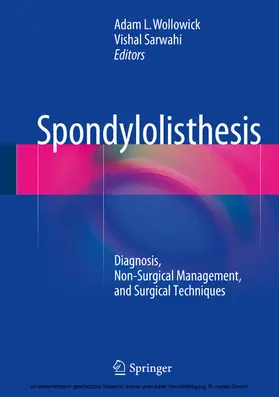 Wollowick / Sarwahi |  Spondylolisthesis | eBook | Sack Fachmedien