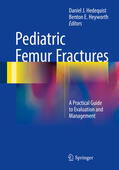 Hedequist / Heyworth |  Pediatric Femur Fractures | eBook | Sack Fachmedien