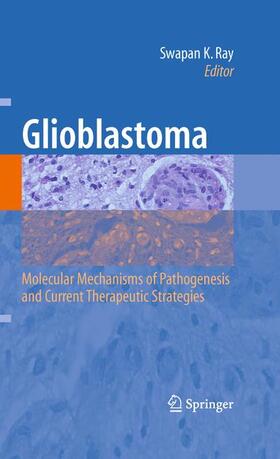 Ray |  Glioblastoma: | Buch |  Sack Fachmedien