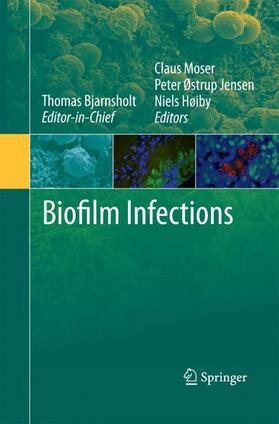 Bjarnsholt / Høiby / Jensen | Biofilm Infections | Buch | 978-1-4899-8228-5 | sack.de