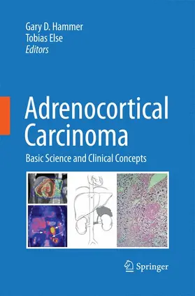 Hammer / Else |  Adrenocortical Carcinoma | Buch |  Sack Fachmedien