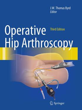 Byrd | Operative Hip Arthroscopy | Buch | 978-1-4899-8641-2 | sack.de