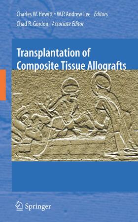 Hewitt / Lee | Transplantation of Composite Tissue Allografts | Buch | 978-1-4899-8807-2 | sack.de