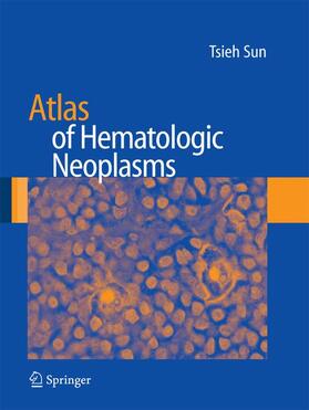 Sun |  Atlas of Hematologic Neoplasms | Buch |  Sack Fachmedien