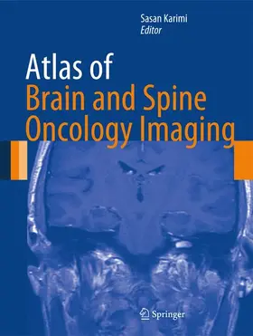 Karimi |  Atlas of Brain and Spine Oncology Imaging | Buch |  Sack Fachmedien